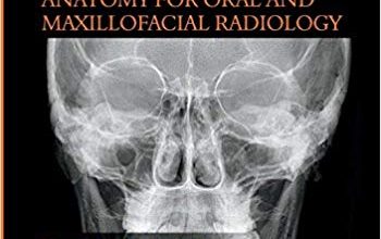 دانلود کتاب Anatomy for Oral and Maxillofacial Radiology خرید ایبوک آناتومی رادیولوژی دهان و فک و صورت ISBN-10: 1681086220ISBN-13: 978-1681086224