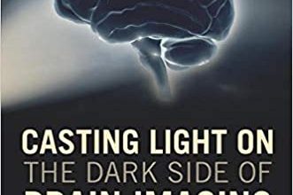 خرید ایبوک Casting Light on the Dark Side of Brain Imaging دانلود کتاب ریخته گری نور در قسمت تاریک تصویربرداری از مغز ISBN-13: 978-0128161791