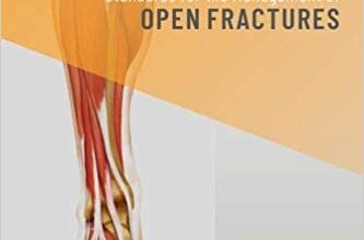 دانلود کتاب Standards for the Management of Open Fractures دانلود ایبوک استانداردهای مدیریت شکستگی های باز