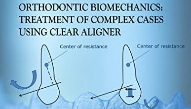 دانلود کتاب Orthodontic Biomechanics Treatment Of Complex Cases Using Clear Aligner دانلود ایبوک درمان بیومکانیک ارتودنسی موارد پیچیده
