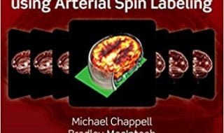 خرید ایبوک Introduction to Perfusion Quantification using Arterial Spin Labelling دانلود کتاب مقدمه ای بر کوانتیزاسیون عطر و طعم با استفاده از برچسب گذاری اسپین شریانی نسخه کیندل download Theobald PDF خرید kindle از امازون