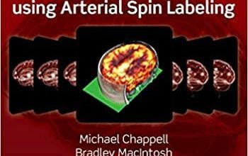 خرید ایبوک Introduction to Perfusion Quantification using Arterial Spin Labelling دانلود کتاب مقدمه ای بر کوانتیزاسیون عطر و طعم با استفاده از برچسب گذاری اسپین شریانی نسخه کیندل download Theobald PDF خرید kindle از امازون