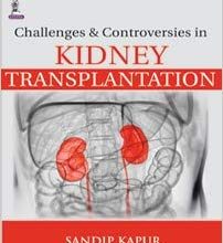 خرید ایبوک Challenges and Controversies in Kidney Transplantation دانلود کتاب چالش ها و اختلافات در پیوند کلیه