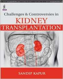 خرید ایبوک Challenges and Controversies in Kidney Transplantation دانلود کتاب چالش ها و اختلافات در پیوند کلیه