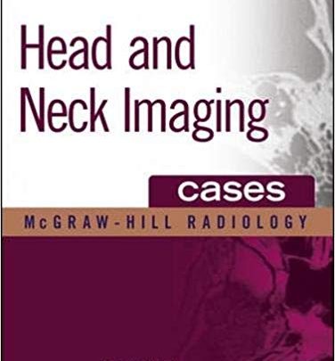 خرید ایبوک Head and Neck Imaging Cases دانلود موارد تصویربرداری سر و گردن