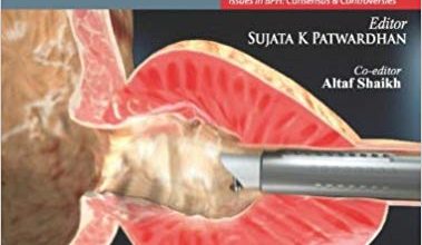 خرید ایبوک Common Urologic Problems: Benign Prostatic Hyperplasia دانلود مشکلات متداول اورولوژی: هیپرپلازی خوش خیم پروستات