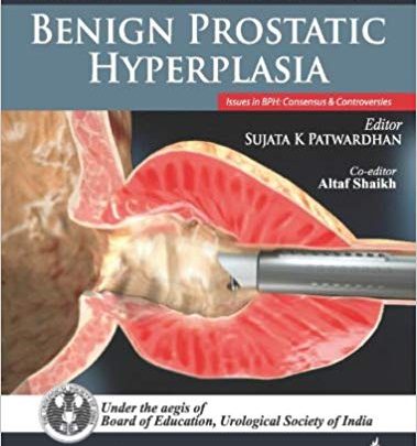 خرید ایبوک Common Urologic Problems: Benign Prostatic Hyperplasia دانلود مشکلات متداول اورولوژی: هیپرپلازی خوش خیم پروستات