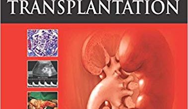 خرید ایبوک Kidney and Pancreas Transplantation دانلود کتاب پیوند کلیه و پانکراس