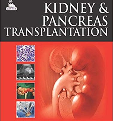 خرید ایبوک Kidney and Pancreas Transplantation دانلود کتاب پیوند کلیه و پانکراس