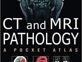خرید ایبوک CT & MRI Pathology: A Pocket Atlas, Second Edition دانلود کتاب CT و MRI آسیب شناسی: اطلس پاکت، نسخه دوم