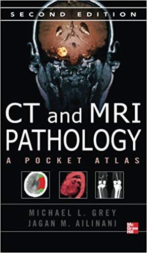 خرید ایبوک CT & MRI Pathology: A Pocket Atlas, Second Edition دانلود کتاب CT و MRI آسیب شناسی: اطلس پاکت، نسخه دوم