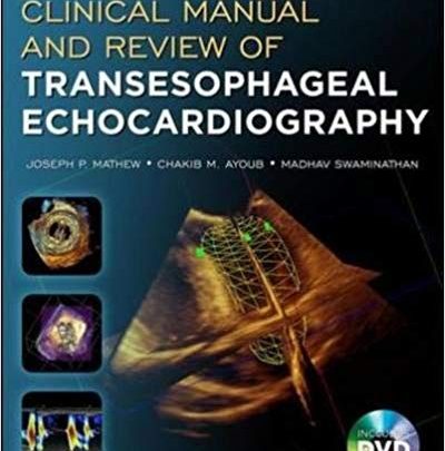 خرید ایبوک Clinical Manual and Review of Transesophageal Echocardiography, Second Edition دانلود کتاب راهنمای بالینی و بررسی اکوکاردیوگرافی ترانسفعال، ویرایش دوم