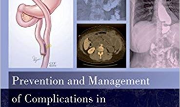 خرید ایبوک Prevention and Management of Complications in Bariatric Surgery دانلود پیشگیری و مدیریت عوارض در جراحی چاقی