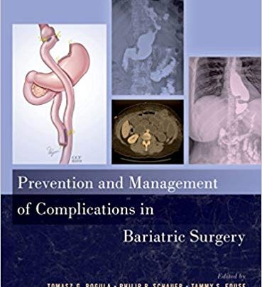 خرید ایبوک Prevention and Management of Complications in Bariatric Surgery دانلود پیشگیری و مدیریت عوارض در جراحی چاقی