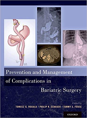 دانلود کتاب Prevention and Management of Complications in Bariatric Surgery
