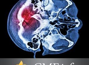 دانلود فیلم UW Emergency Radiology Review خرید ویدیو بررسی رادیولوژی اضطراری UW از oakstone دانلود از oakstone.com ویدیو CMEInfo oakstone