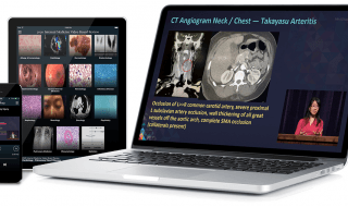 دانلود فیلم Medstudy Internal Medicine Video Board Review 2017 MOC Exam Review-Videos خرید Medstudy Review Video Board Board Medical Medical 2017 بررسی نقد و بررسی فیلم MOC از oakstone دانلود از oakstone.com ویدیو CMEInfo oakstone
