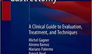 خرید ایبوک The Perfect Sleeve Gastrectomy دانلود کتاب آستین کامل معده