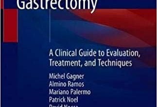 خرید ایبوک The Perfect Sleeve Gastrectomy دانلود کتاب آستین کامل معده