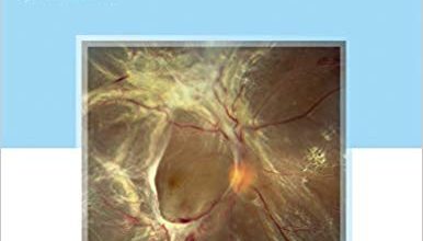 دانلود کتاب The Retina Illustrated خرید ایبوک شبکیه چشم مصور