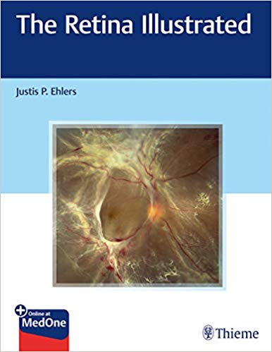 دانلود کتاب The Retina Illustrated خرید ایبوک شبکیه چشم مصور