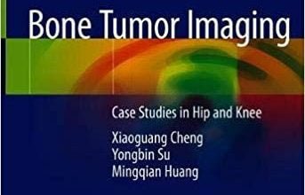خرید ایبوک Bone Tumor Imaging Case Studies in Hip and Knee نسخه 2020 دانلود کتاب مطالعات موردی تصویربرداری تومور استخوانی در هیپ و زانو نسخه 2020