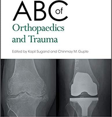 دانلود کتاب ABC of orthopaedics and trauma خرید ایبوک ABC ارتوپدی و تروما