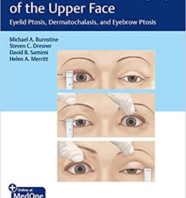 خرید ایبوک Ophthalmic Plastic Surgery of the Upper Face دانلود کتاب جراحی پلاستیک چشم از قسمت فوقانی صورت