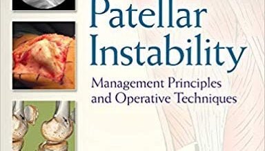 خرید ایبوک Patellar Instability Management Principles and Operative Techniques دانلود کتاب اصول مدیریت بی ثباتی Patellar و تکنیک های عملیاتی