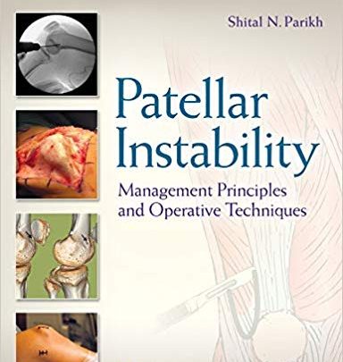 خرید ایبوک Patellar Instability Management Principles and Operative Techniques دانلود کتاب اصول مدیریت بی ثباتی Patellar و تکنیک های عملیاتی