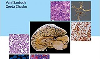 خرید ایبوک Essentials of Diagnostic Surgical Neuropathology دانلود کتاب ملزومات نوروپاتولوژی جراحی تشخیصی
