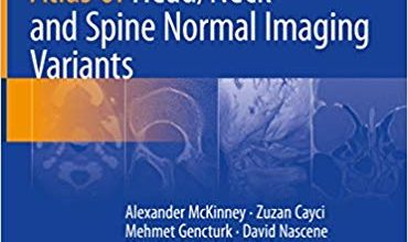 دانلود کتاب Atlas of Head Neck and Spine Normal Imaging Variants خرید کتاب Atlas of Head گردن و ستون فقرات انواع تصویربرداری طبیعی