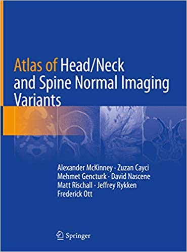 دانلود کتاب Atlas of Head Neck and Spine Normal Imaging Variants