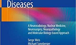 دانلود کتاب Imaging Brain Diseases A Neuroradiology Nuclear Medicine Neurosurgery Neuropathology Molecular Biology-based Approach خرید کتاب تصویربرداری از مغز مغز A Neuroradiology هسته ای پزشکی هسته ای Neuropathology Neuropathology رویکرد مبتنی بر زیست شناسی مولکولی