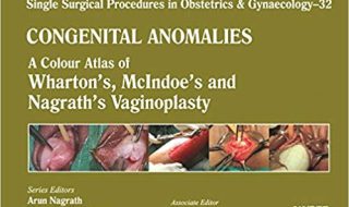 دانلود کتاب Congenital Anomalies: A Colour Atlas of Wharton's, Mcindoe's and Nagrath's Vaginoplasty خرید ایبوک ناهنجاری های مادرزادی: اطلس رنگی از واگنون ، مکیندو و واگرینوپلاستی نگرات
