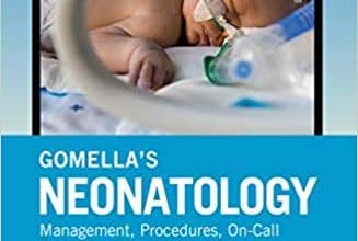 دانلود کتاب Gomella's Neonatology Management Procedures On-Call Problems Diseases and Drugs 2020 8e خرید ایبوک نوزادان گومِلا نسخه 8