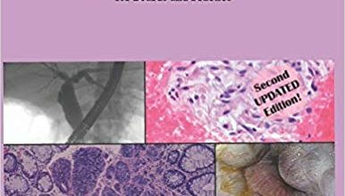 دانلود کتاب Gastroenterology Clinical Focus High yield GI and hepatology review for Boards and Practice 2nd edition خرید ایبوک تمرکز کلینیکی معده با دستگاه گوارش با بررسی عملکرد بالای دستگاه گوارش و عملکرد کبدی برای تابلوهای و تمرین نسخه 2