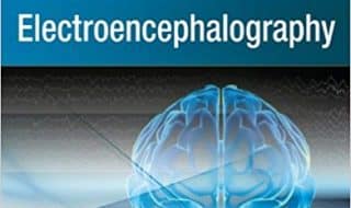 خرید ایبوک Practical Approach to Electroencephalography دانلود کتاب رویکرد عملی به الکتروانسفالوگرافی Language: EnglishASIN: B007V2NPB6