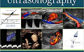 دانلود کتاب Introduction to Vascular Ultrasonography 7th Edition خرید کتاب مقدمه ای بر سونوگرافی عروقی نسخه هفتم Language: EnglishASIN: B07YX5C2CK
