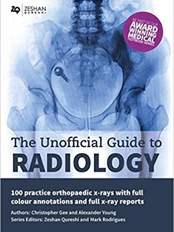 دانلود کتاب The Unofficial Guide Radiology 100 Practice Orthopaedic X Rays with Full Colour Annotations Full دانلود ایبوک راهنمای غیررسمی رادیولوژی