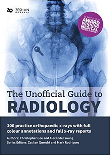 دانلود کتاب The Unofficial Guide to Radiology 100 Practice Orthopaedic X Rays with Full Colour Annotations and Full X Ray Reports