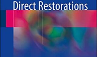 دانلود کتاب Dental Composite Materials for Direct Restorations خرید ایبوک مواد کامپوزیت دندان برای ترمیم مستقیم ISBN-10: 3319609602 ISBN-13: 978-3319609607