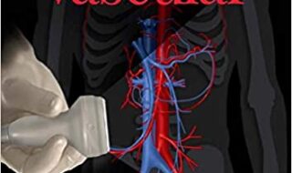 دانلود کتاب Diagnostic Ultrasound Vascular دانلود ایبوک تصویربرداری تشخیصی انکولوژی نسخه دوم ISBN-13: 978-0323624428 ISBN-10: 0323624421