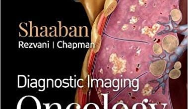 دانلود کتاب Diagnostic Imaging Oncology 2nd Edition دانلود ایبوک تصویربرداری تشخیصی انکولوژی نسخه دوم ISBN-10: 0323661122