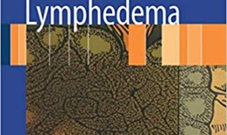 ایبوک Lymphedema Diagnosis and Treatment خرید کتاب تشخیص و درمان لنف ادم ISBN-13: 978-1846285486 ISBN-10: 1846285488