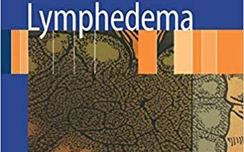 ایبوک Lymphedema Diagnosis and Treatment خرید کتاب تشخیص و درمان لنف ادم ISBN-13: 978-1846285486 ISBN-10: 1846285488