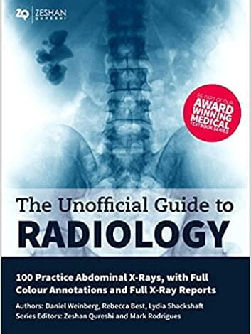 ایبوک The Unofficial Guide to Radiology 100 Practice Abdominal X Rays خرید کتاب راهنمای غیر رسمی رادیولوژی 100 پرتوهای ایکس را تمرین کنید