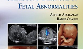 دانلود کتاب سونوگرافی سه ماهه اول تشخیص ناهنجاری های جنینی دانلود ایبوک First Trimester Ultrasound Diagnosis of Fetal Abnormalities