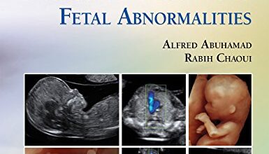 دانلود کتاب سونوگرافی سه ماهه اول تشخیص ناهنجاری های جنینی دانلود ایبوک First Trimester Ultrasound Diagnosis of Fetal Abnormalities