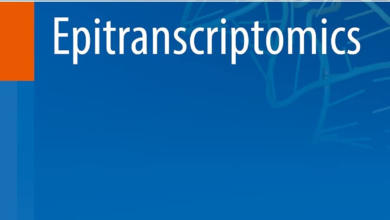 دانلود کتاب Epitranscriptomics دانلود ایبوک اپی ترانسکریپتومیکس ISBN-10 ‏ : ‎ 3030716147 انتشارات Springer